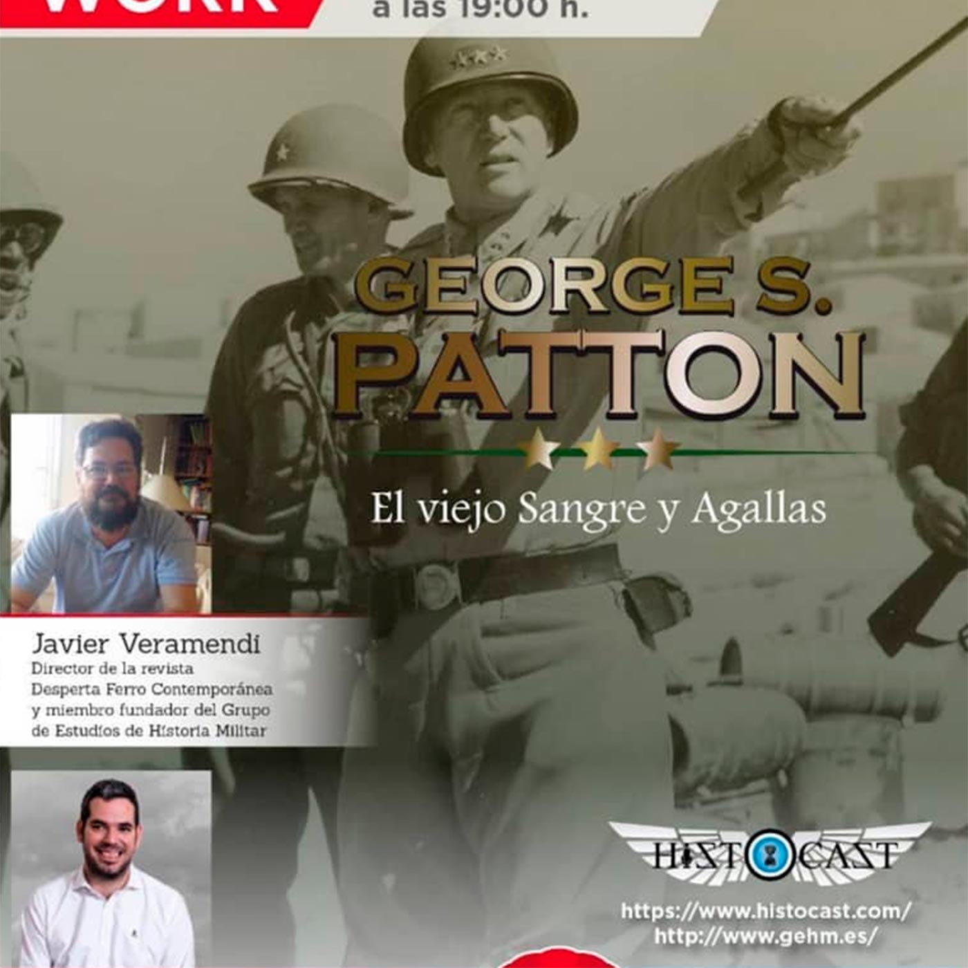 Histocast